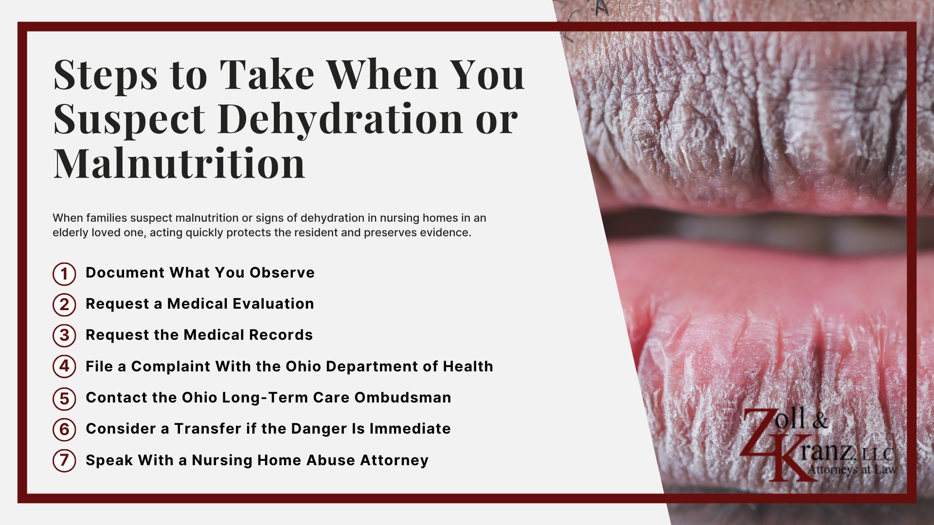 Steps to Take When You Suspect Dehydration or Malnutrition; Federal and Ohio Standards for Nutrition and Hydration; Serious Health Complications From Dehydration and Malnutrition; Common Causes of Dehydration and Malnutrition in Nursing Homes; Warning Signs of Malnutrition in Nursing Home Residents; Warning Signs of Dehydration in Nursing Home Residents; Who Can Report Nursing Home Abuse