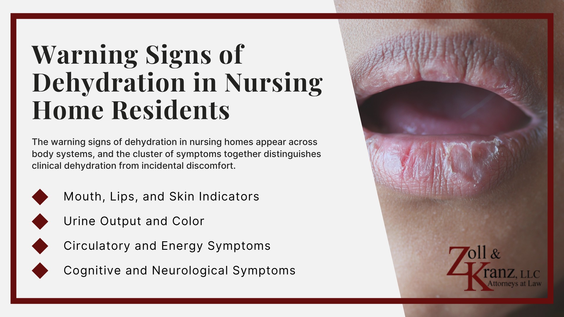 Warning Signs of Dehydration in Nursing Home Residents; Who Can Report Nursing Home Abuse