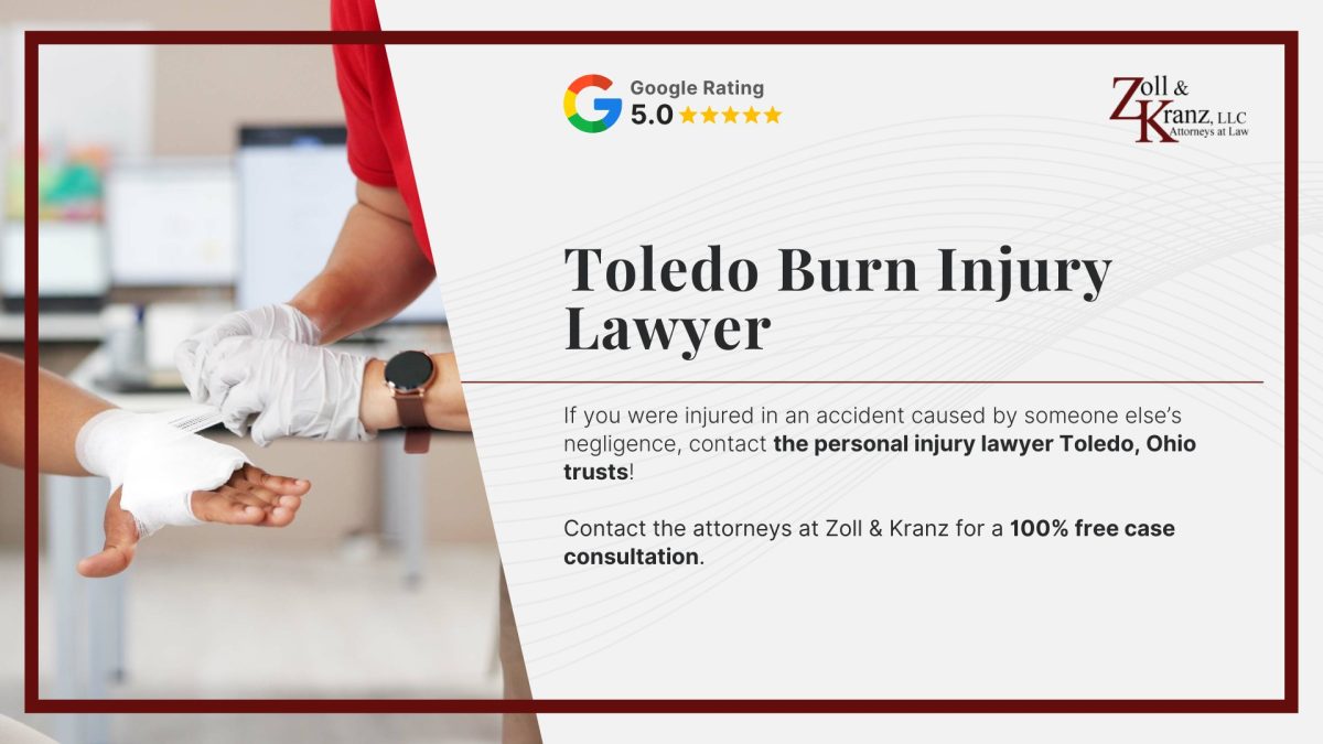 Toledo Burn Injury Lawyer