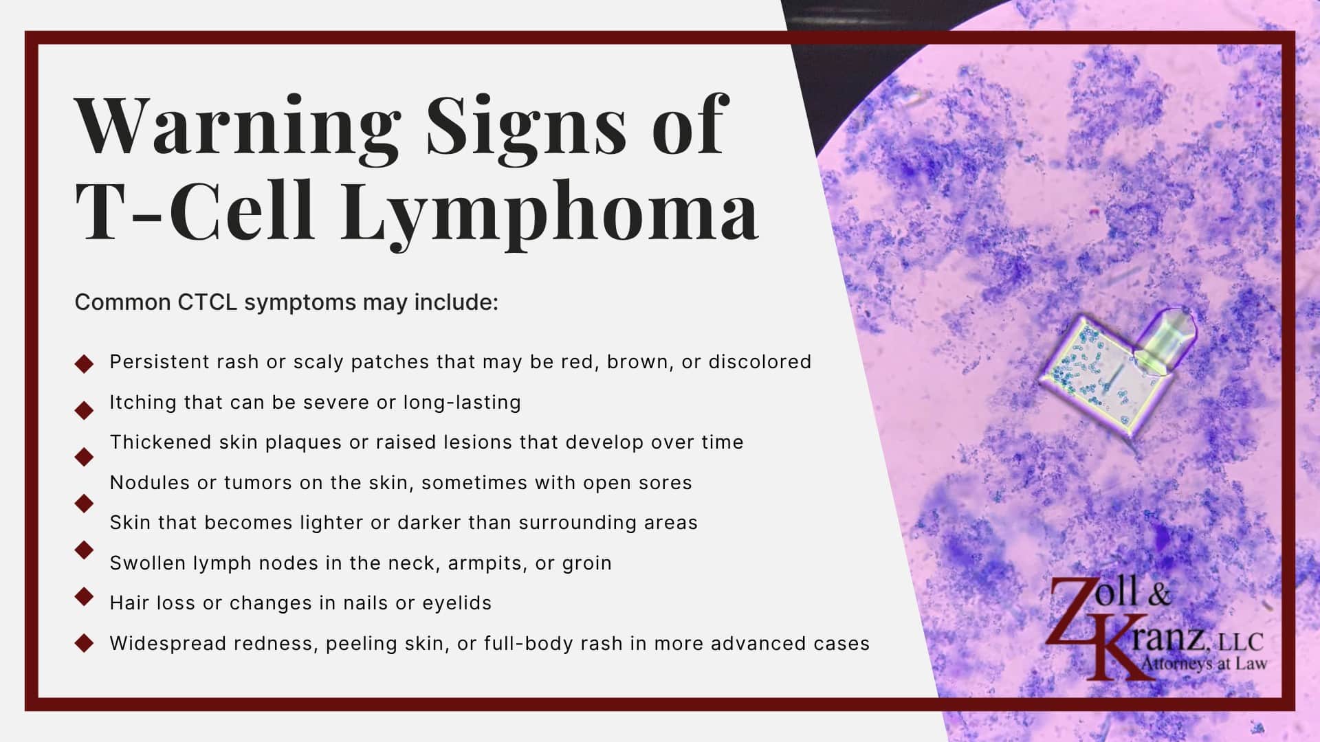 Warning Signs of T-Cell Lymphoma; Is Dupixent Linked to Lymphoma; Dupixent Lawsuit Investigation Overview; Who Uses Dupixent; What is Dupixent